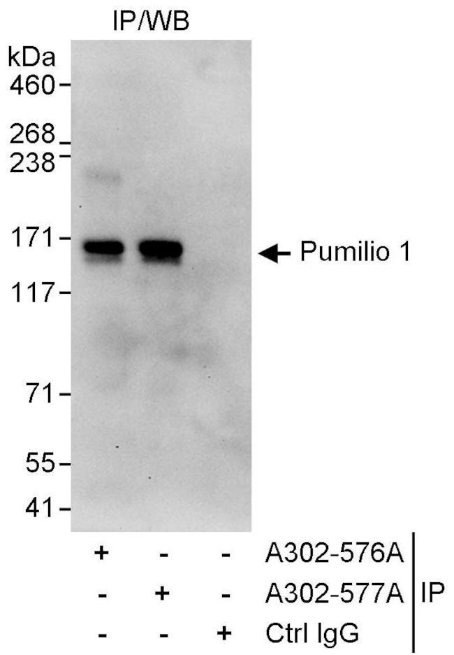 Pumilio 1 Antibody in Immunoprecipitation (IP)