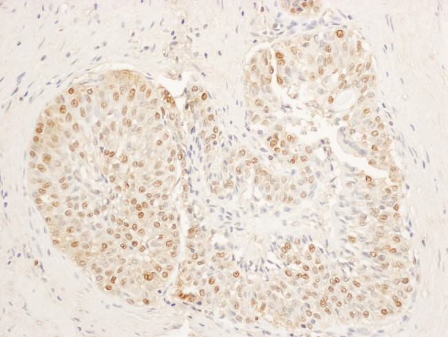 SA1 Antibody in Immunohistochemistry (Paraffin) (IHC (P))