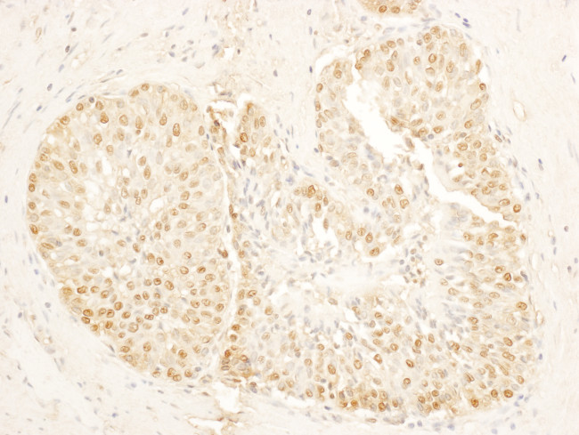 SA1 Antibody in Immunohistochemistry (Paraffin) (IHC (P))