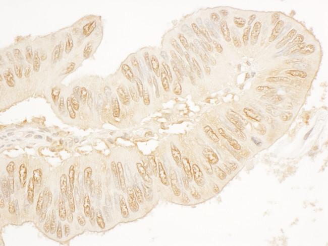 SA2 Antibody in Immunohistochemistry (Paraffin) (IHC (P))