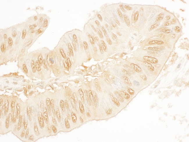 SA2 Antibody in Immunohistochemistry (Paraffin) (IHC (P))