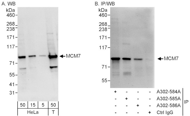 MCM7 Antibody in Western Blot (WB)