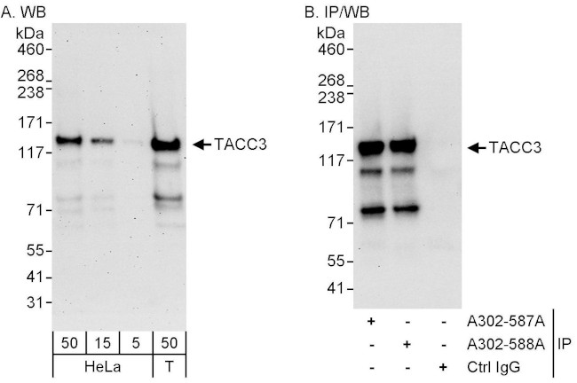 TACC3 Antibody in Western Blot (WB)