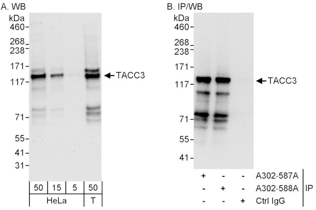 TACC3 Antibody in Western Blot (WB)