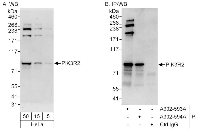 PIK3R2 Antibody in Western Blot (WB)