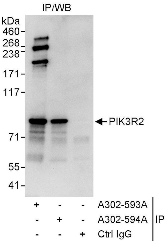 PIK3R2 Antibody in Immunoprecipitation (IP)