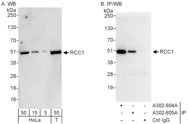 RCC1 Antibody in Western Blot (WB)