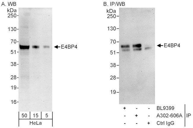 E4BP4 Antibody in Western Blot (WB)