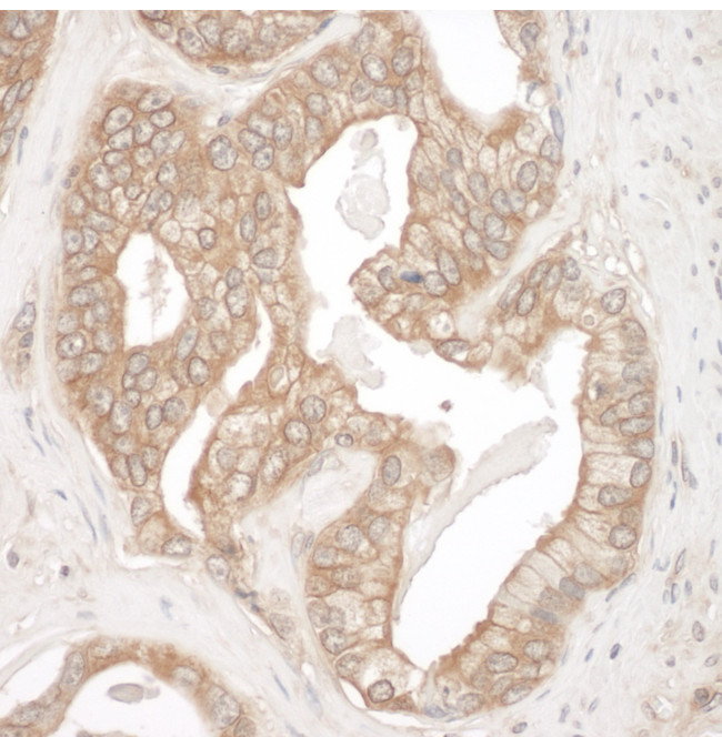 Cortactin Antibody in Immunohistochemistry (Paraffin) (IHC (P))