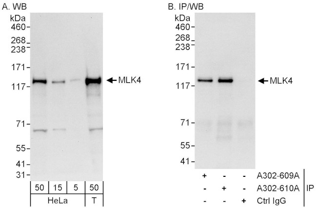 MLK4 Antibody in Western Blot (WB)