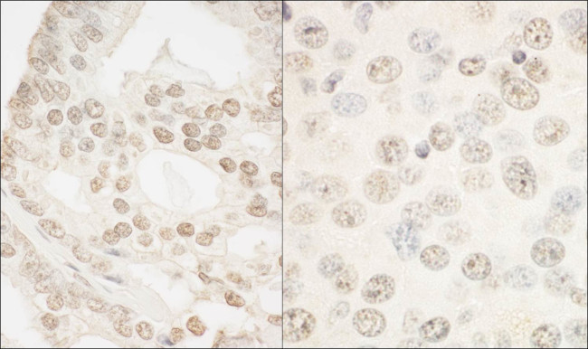 FOXP1 Antibody in Immunohistochemistry (Paraffin) (IHC (P))