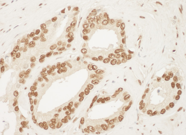 Ku70 Antibody in Immunohistochemistry (Paraffin) (IHC (P))
