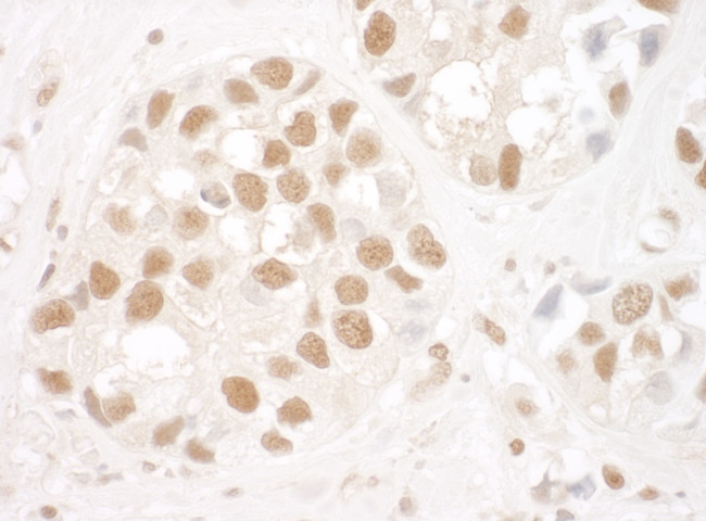 Ku80 Antibody in Immunohistochemistry (Paraffin) (IHC (P))