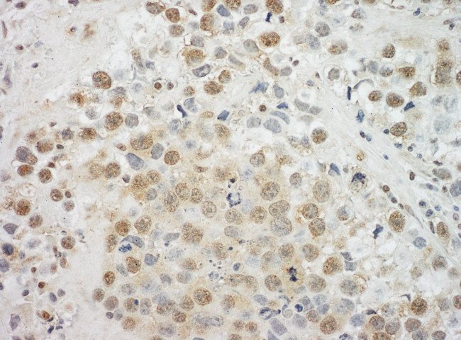 EYA4 Antibody in Immunohistochemistry (Paraffin) (IHC (P))