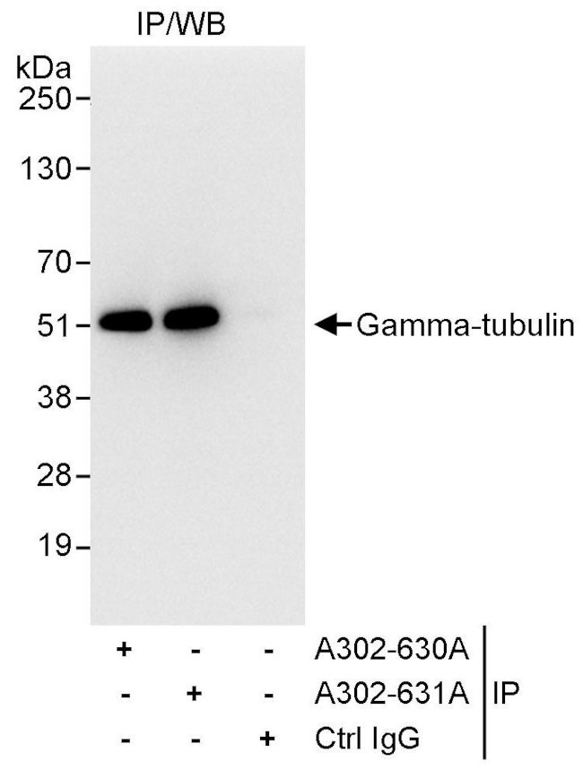 Gamma-Tubulin Antibody in Immunoprecipitation (IP)