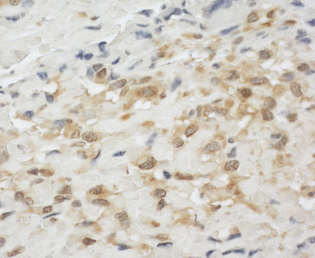 LPP Antibody in Immunohistochemistry (Paraffin) (IHC (P))