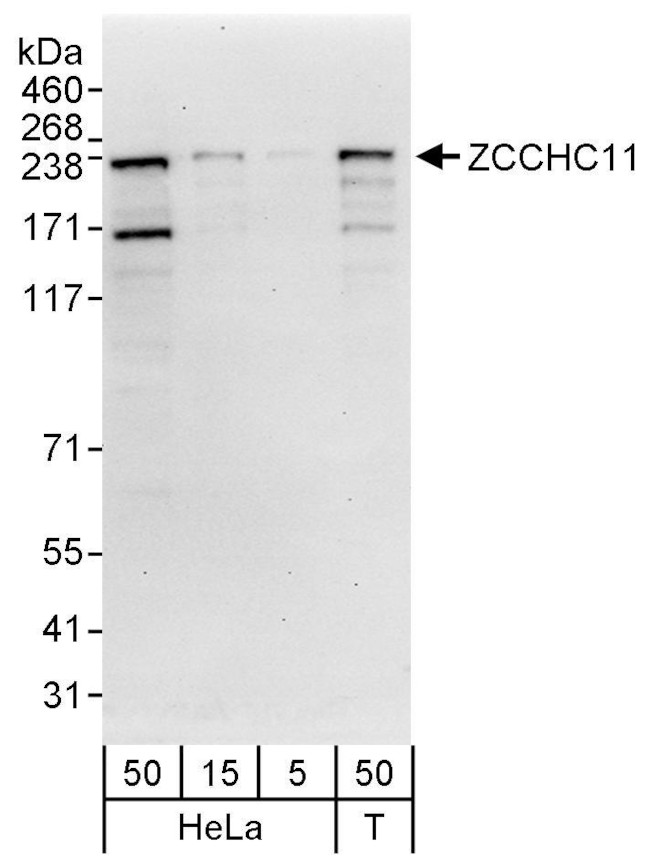 ZCCHC11 Antibody in Western Blot (WB)
