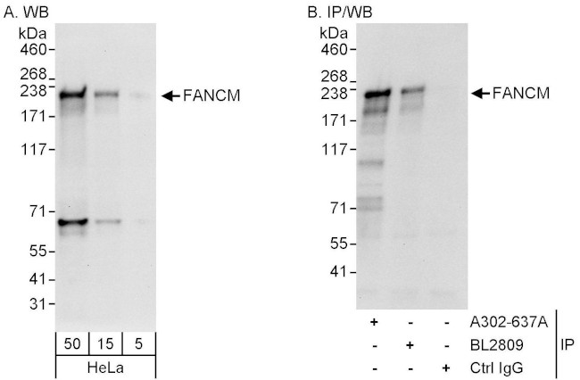 FANCM Antibody in Western Blot (WB)