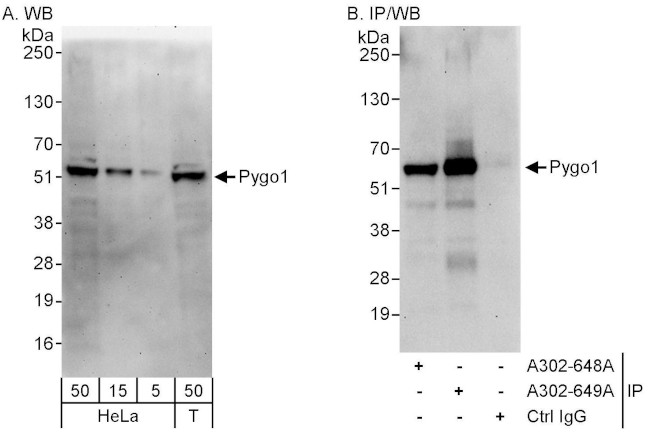 Pygo1 Antibody in Western Blot (WB)