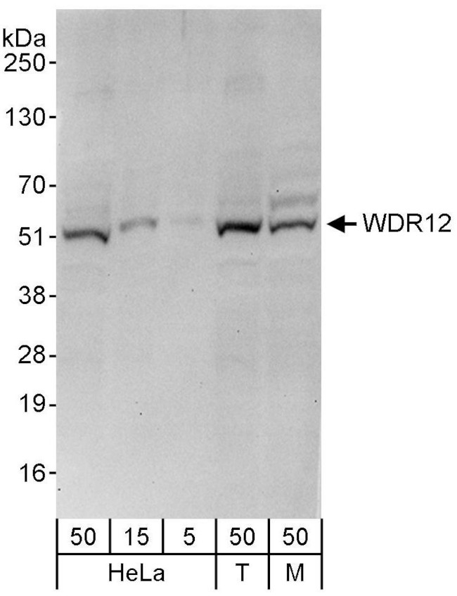 WDR12 Antibody in Western Blot (WB)
