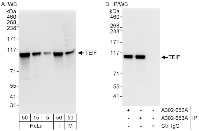 TEIF Antibody in Western Blot (WB)