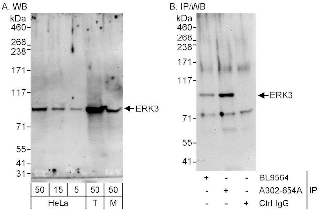 ERK3 Antibody in Western Blot (WB)