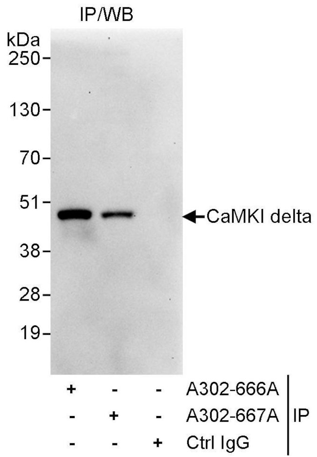CaMKI delta Antibody in Immunoprecipitation (IP)