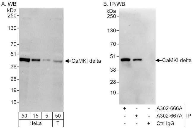 CaMKI delta Antibody in Western Blot (WB)
