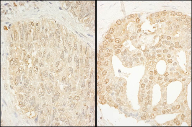 CaMKK alpha Antibody in Immunohistochemistry (Paraffin) (IHC (P))