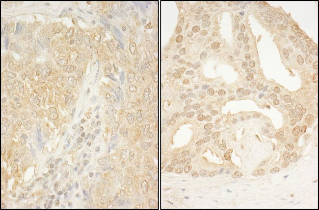 CaMKK alpha Antibody in Immunohistochemistry (Paraffin) (IHC (P))