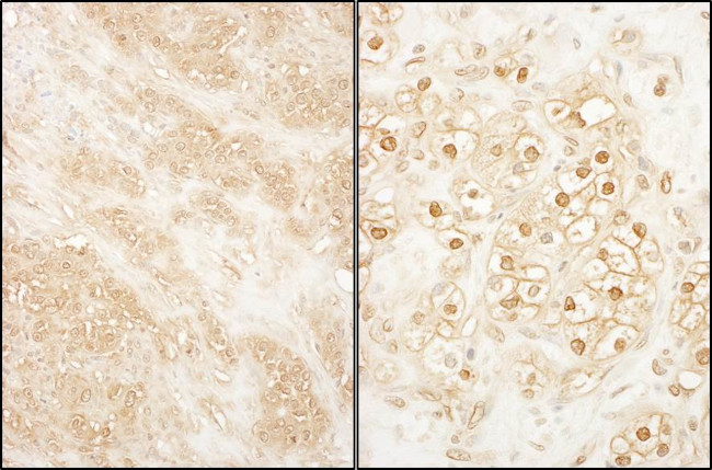 PCTAIRE 2 Antibody in Immunohistochemistry (Paraffin) (IHC (P))