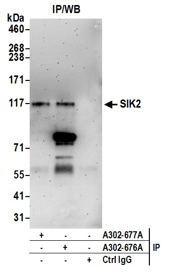 SIK2 Antibody in Immunoprecipitation (IP)