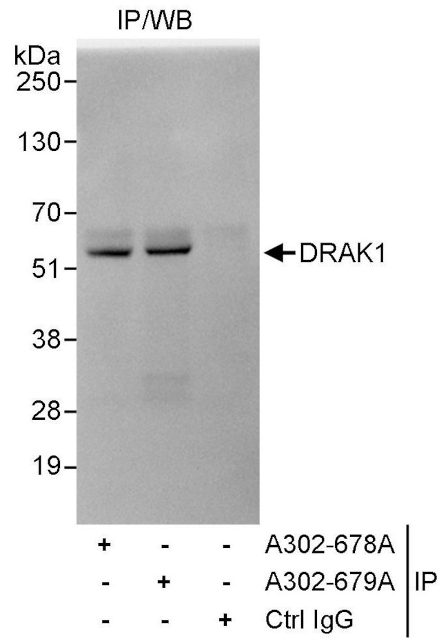 DRAK1 Antibody in Immunoprecipitation (IP)