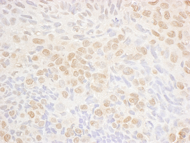 DRAK1 Antibody in Immunohistochemistry (Paraffin) (IHC (P))
