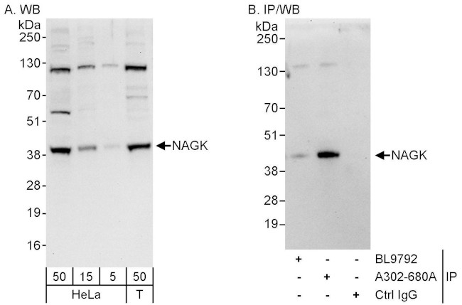 NAGK Antibody in Western Blot (WB)