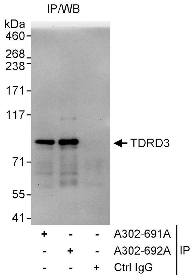 TDRD3 Antibody in Immunoprecipitation (IP)