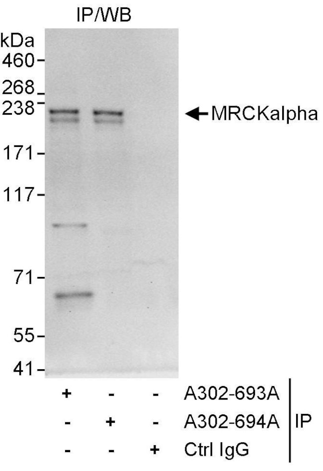 MRCKalpha Antibody in Immunoprecipitation (IP)