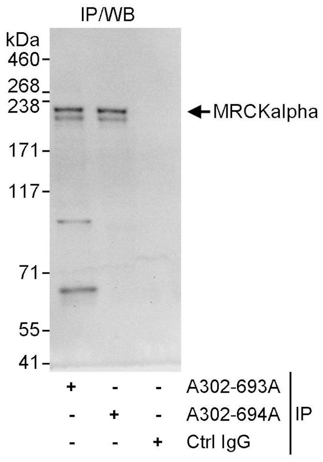 MRCKalpha Antibody in Immunoprecipitation (IP)