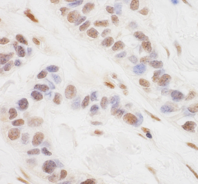 TORC3 Antibody in Immunohistochemistry (Paraffin) (IHC (P))