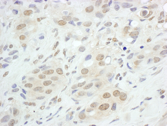 JunB Antibody in Immunohistochemistry (Paraffin) (IHC (P))