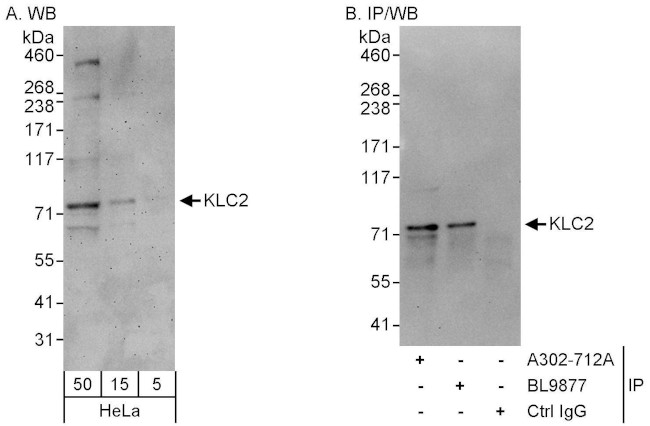 KLC2 Antibody in Western Blot (WB)