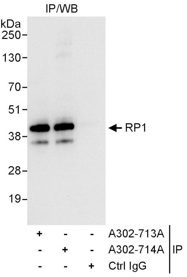 RP1 Antibody in Immunoprecipitation (IP)