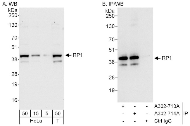 RP1 Antibody in Western Blot (WB)