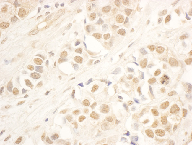 NOP58 Antibody in Immunohistochemistry (Paraffin) (IHC (P))