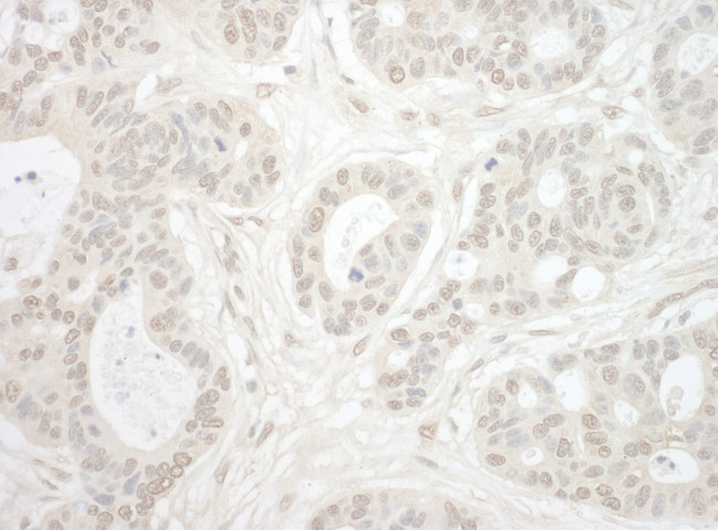 Importin 4 Antibody in Immunohistochemistry (Paraffin) (IHC (P))