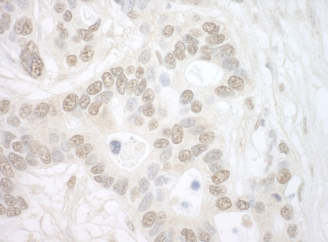 Importin 4 Antibody in Immunohistochemistry (Paraffin) (IHC (P))