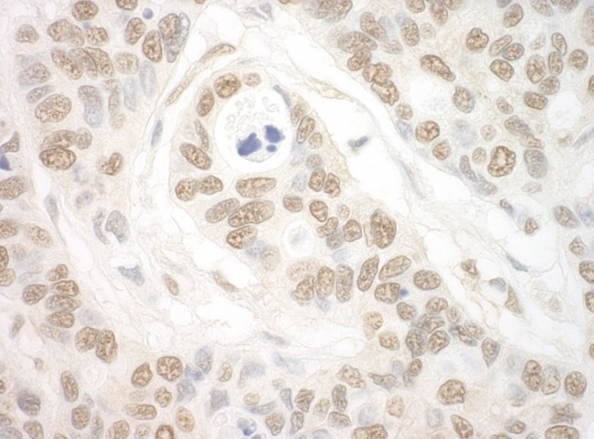 Importin 7 Antibody in Immunohistochemistry (Paraffin) (IHC (P))