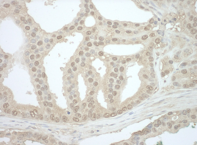 Bin1 Antibody in Immunohistochemistry (Paraffin) (IHC (P))