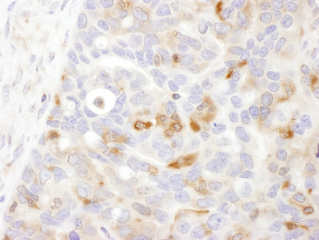 Bin1 Antibody in Immunohistochemistry (Paraffin) (IHC (P))