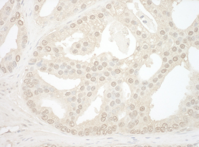 NOL12 Antibody in Immunohistochemistry (Paraffin) (IHC (P))
